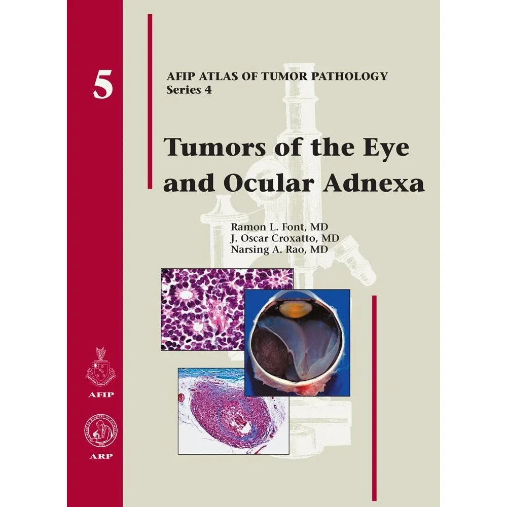 Tumors of the Eye and Ocular Adnexa (Afip Atlas of Tumor Pathology)